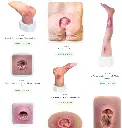 all wounds models.webp