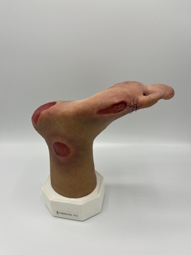 [Diab-6] Wondmodel Diabetisch voet 