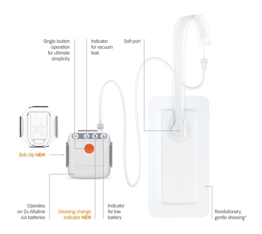 PICO® 7 Single Use Negative Pressure System